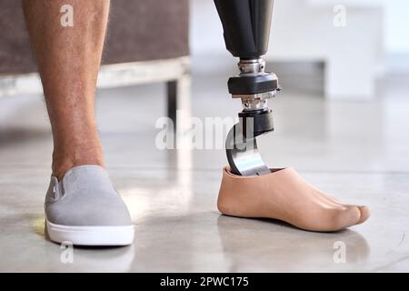 Amputee man with above knee leg prosthesis standing on feet, close up. Stock Photo