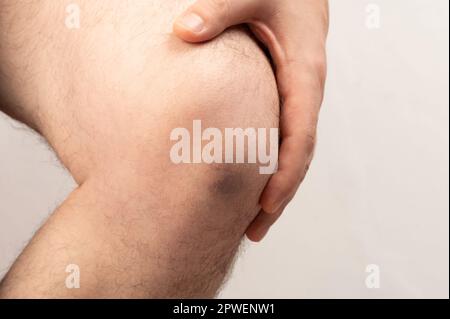 Doctor check hurt knee macro close up view isolated Stock Photo