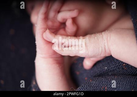 A tiny cute baby born one week old. Newborn peeling. Newborn Baby's hands and face skin with skin peels. close up of hands new baby born details. Stock Photo