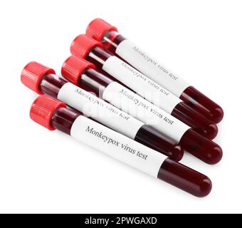 Monkeypox virus test. Many sample tubes with blood in rack on white ...