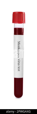 Sample tube with label Monkeypox Virus Test and blood on medical form ...