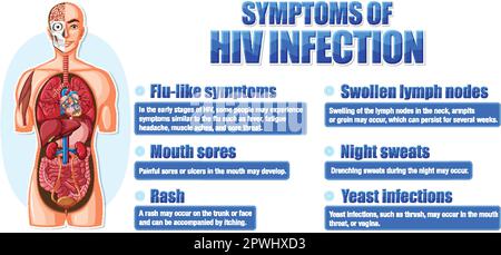 Informative poster of common symptoms of HIV illustration Stock Vector ...