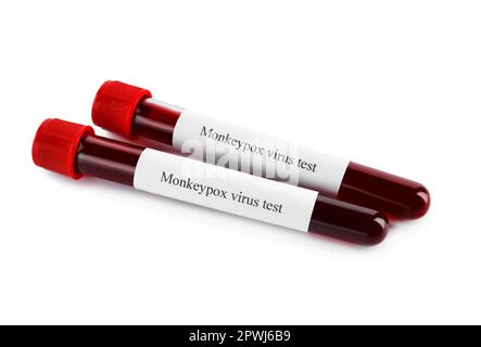 Monkeypox virus test. Sample tubes with blood on white background Stock Photo