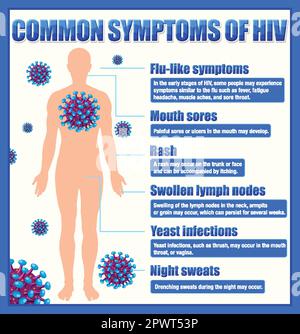 Informative poster of common symptoms of HIV illustration Stock Vector ...