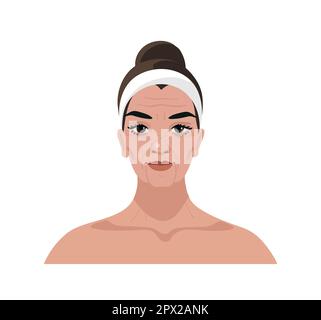 Portrait of a mature woman with wrinkles and age changes, cosmetic procedures, injections, plastic surgery, vector cartoon illustration isolated on a Stock Vector