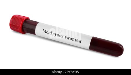 Monkeypox virus test. Sample tube with blood isolated on white Stock ...