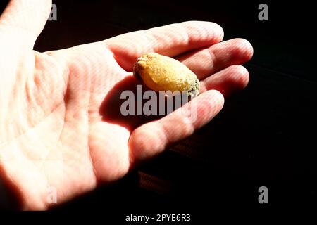 Gallstone disease, cholelithiasis - the formation of stones, stones in the gallbladder, bile ducts. Gallstones. A large gallstone removed from a patient's body, 2.5 cm long. Stock Photo