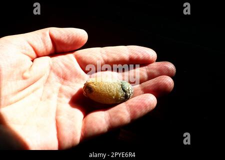 Gallstone disease, cholelithiasis - the formation of stones, stones in the gallbladder, bile ducts. Gallstones. A large gallstone removed from a patient's body, 2.5 cm long. Stock Photo