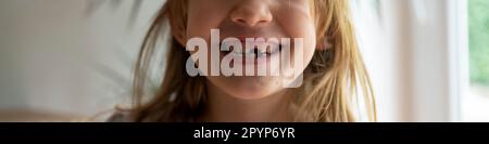 Closeup view of an adorable toddler girl smiling with two of her milk teeth missing. Wide view image. Stock Photo