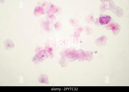 Human buccal smear under the microscope showing desquamated squamous cells of the oral mucosae, light photomicrograph, hematoxylin eosin staining Stock Photo