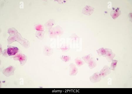 Human buccal smear under the microscope showing desquamated squamous cells of the oral mucosae, light photomicrograph, hematoxylin eosin staining Stock Photo
