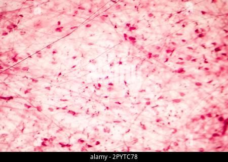 Human loose connective tissue, light photomicrograph, hematoxylin and eosin staining Stock Photo