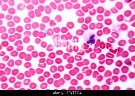 Human blood smear under microscope, light photomicrograph showing red blood cells and neutrophil Stock Photo