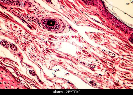 Connective tissue located at human outer ear, light micrograph ...