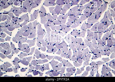 Human skeletal muscle, cross section, light micrograph Stock Photo - Alamy