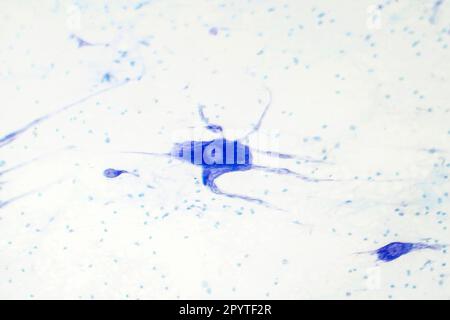 Light micrograph of human brain tissue showing neurons and glial cells Stock Photo