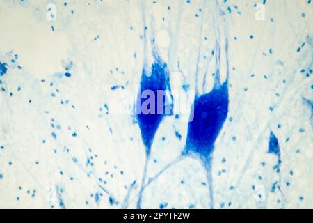 Light micrograph of human brain tissue showing neurons and glial cells Stock Photo