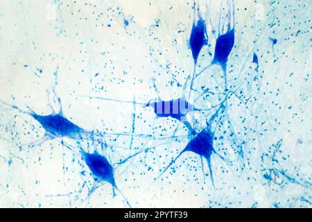 Light micrograph of human brain tissue showing neurons and glial cells Stock Photo