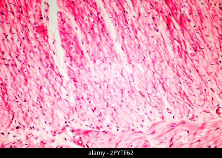 Human smooth muscle, cross section, light micrograph Stock Photo