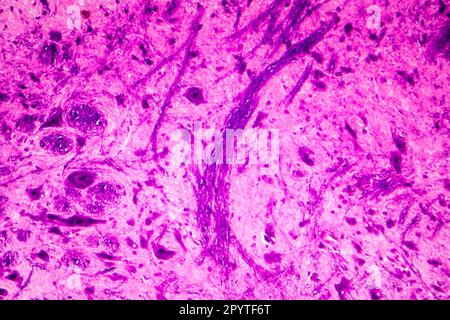Human spinal cord, close-up view, light photomicrograph Stock Photo