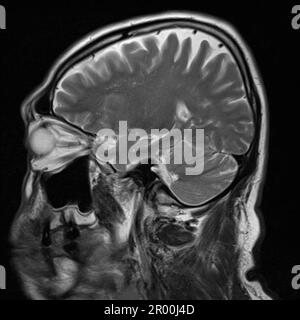 Healthy human brain, MRI scan Stock Photo