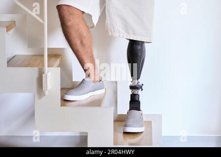 Amputee man with above knee leg prosthesis standing on feet, close up. Stock Photo