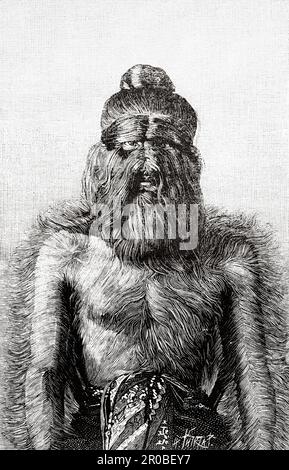 A hairy man from Burma. Old 19th century engraving from La Nature 1887 Stock Photo