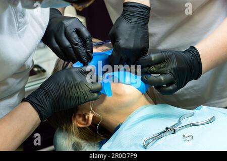 Doctor and help assistant isolate patient's teeth with rubber pad. Isolation tooth female patient for medical manipulations using rubber dam. Restorat Stock Photo