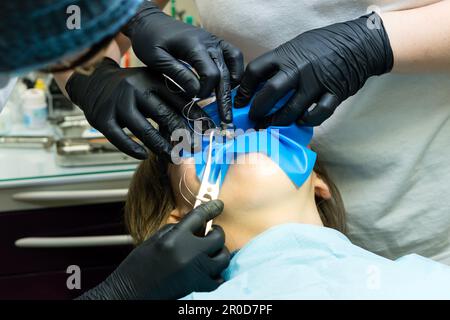 Doctor and help assistant isolate patient's teeth with rubber pad. Isolation tooth female patient for medical manipulations using rubber dam. Restorat Stock Photo