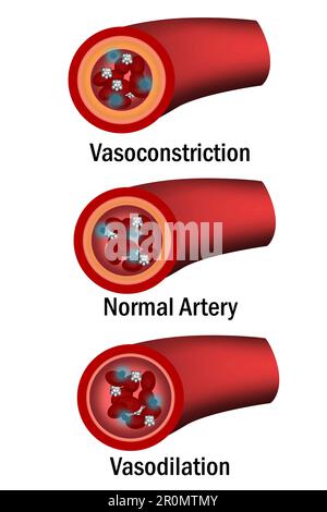 Comparison of normal, vasoconstriction and vasodilation blood vessels ...