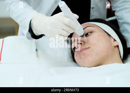 Closeup view of woman having microneedling procedure applied on her face Stock Photo