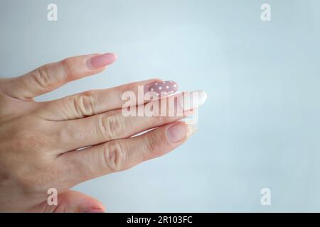 Weak thin nail. Consequences of gel polish manicure. Regrown nails after shellac. Stock Photo