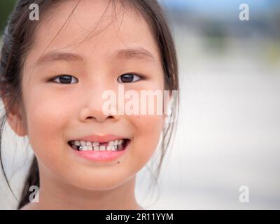 close up shot of face asian child cute or kid girl smiling eyes white teeth and one broken tooth or drop from baby or milk tooth on 7 years old Stock Photo