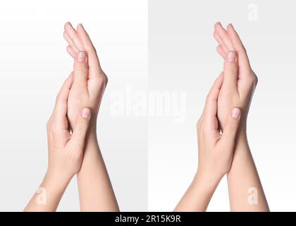 Collage with photos of woman showing hands with dry and moisturized skin on white background, closeup Stock Photo