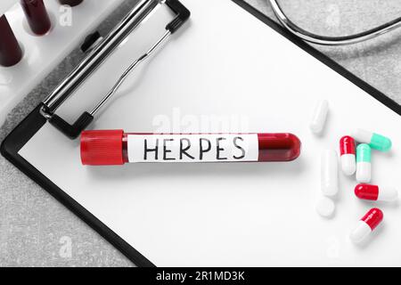 Test tube with word Herpes, different pills and clipboard on light grey table, flat lay Stock Photo