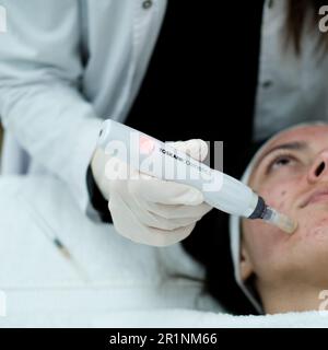 Closeup view of cosmetologist doing microneedling procedure on female patient face Stock Photo