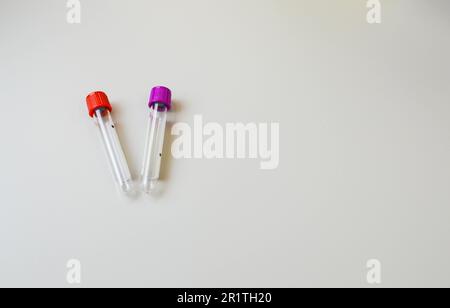 two test tubes with a red and purple cap on a white background. sterile, disposable tubes for venous blood collection. laboratory diagnostics, blood t Stock Photo