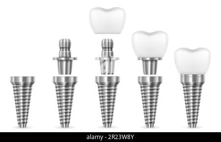 metal human tooth implant vector illustration isolated on white background Stock Vector