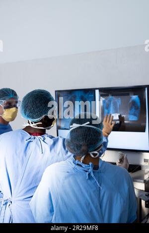 Diverse group of surgeons discussing x rays on screen in operating theatre, copy space Stock Photo