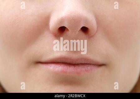 Woman with dry skin, closeup of mouth Stock Photo