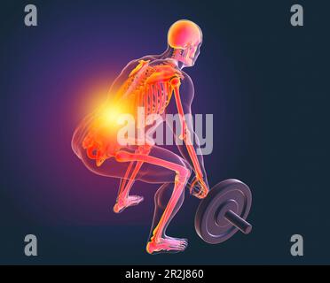 Man with back pain lifting a barbell, illustration Stock Photo