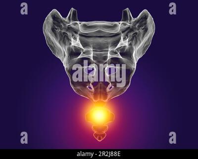 Coccyx pain, conceptual illustration Stock Photo - Alamy