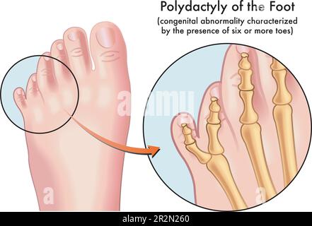 Foot anatomy illustration, with annotations Stock Vector Image & Art ...