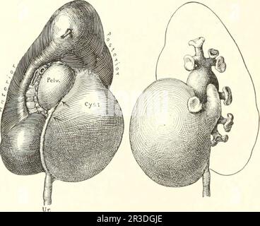 'Diseases of the kidneys, ureters and bladder, with special reference to the diseases of women' (1922) Stock Photo