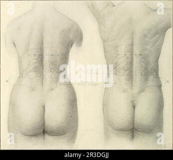 'Diseases of the kidneys, ureters and bladder, with special reference to the diseases of women' (1922) Stock Photo