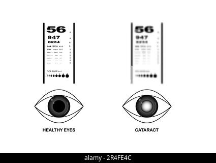 Snellen Chart Image in Vector