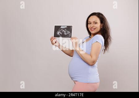 Focus on ultrasound scan image, baby sonography in the hand of a