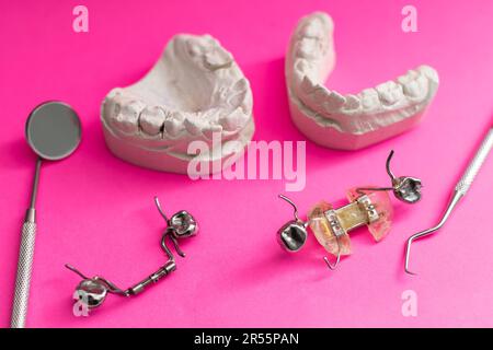 Dental casting gypsum model plaster cast stomatologic human jaws prothetic laboratory. dental plate Stock Photo