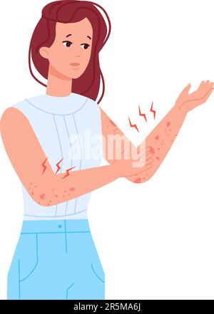 Woman scratching skin. Girl with itching elbow hand or rash on body, allergic infection itchy eczema urticaria pele atopic dermatitis symptoms, skins irritation vector illustration Stock Vector