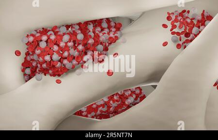 Bone marrow, illustration Stock Photo